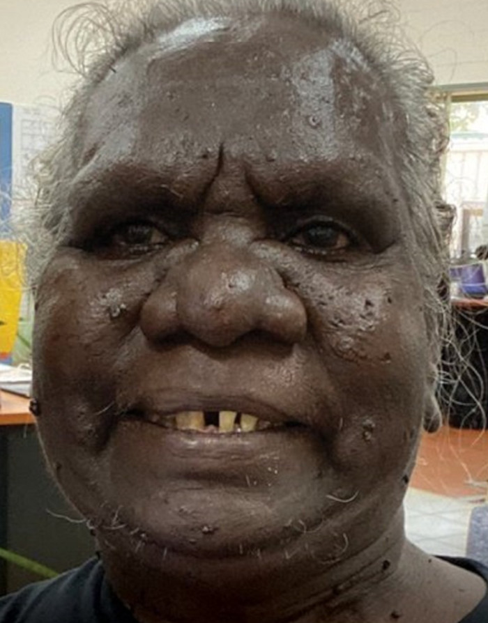 Aboriginal Australian