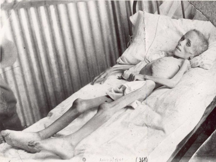 Boer child starvation.