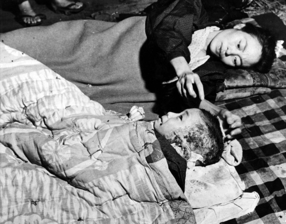 A mother tends to her injured child after the bombing of Hiroshima